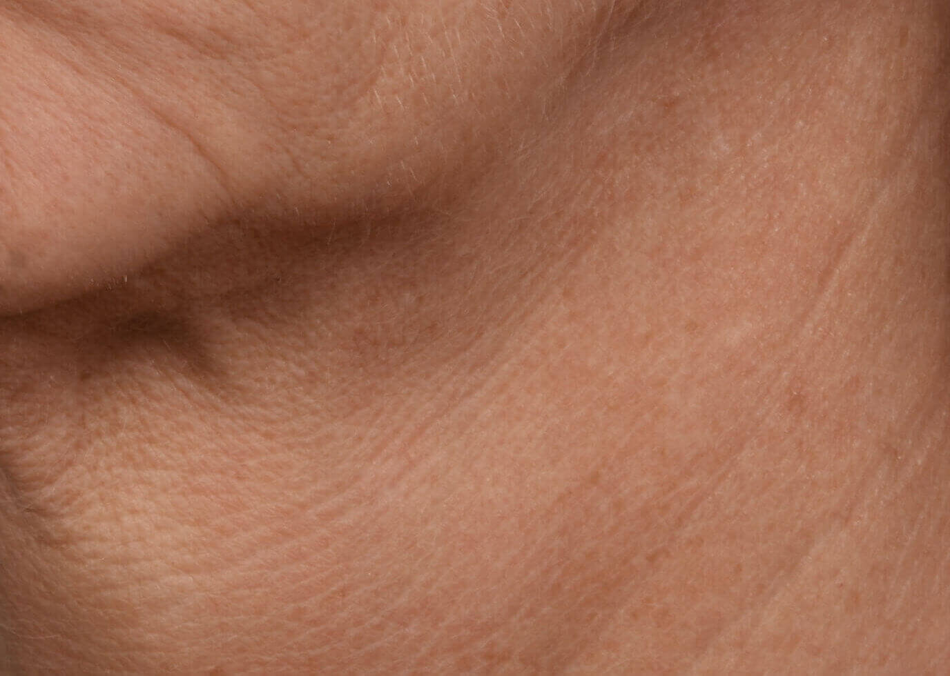 Nachher